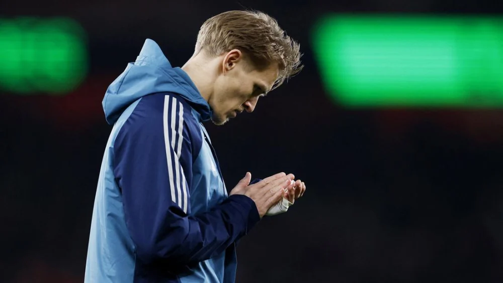 Arsenal Vs MU: Odegaard Akui The Gunners Tak Cukup Bagus, Kekalahan di Kandang Sendiri Menjadi Pukulan Telak di Tengah Persaingan Ketat Premier League