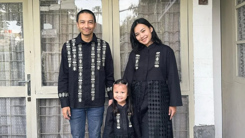Kondisi Kaki Istri Fiersa Besari Usai Ditabrak Mobil: Trauma Otot, Pemulihan 3-6 Minggu, dan Kekecewaan Atas Respons Penabrak