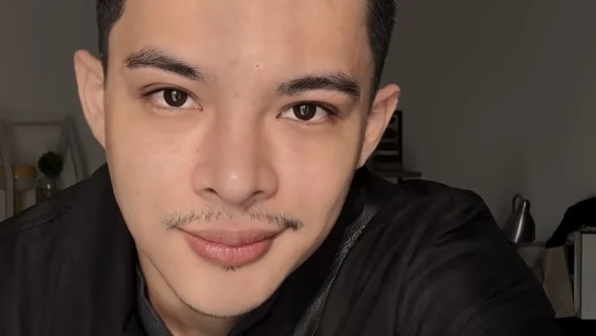 Rey Mbayang Ungkap Perjuangan Melawan Autoimun Psoriasis: Dari Kerontokan Rambut hingga Nyeri Tulang