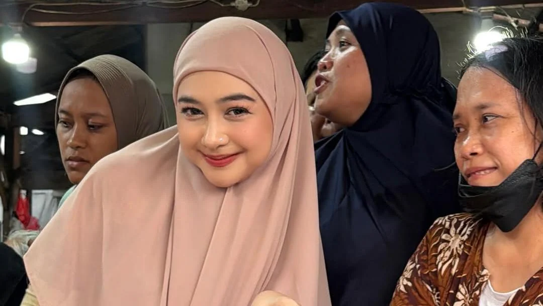 Ria Ricis Luruskan soal Operasi Hidung dan Wajah Berubah