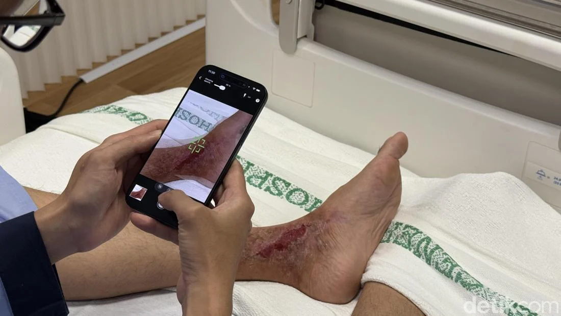 Cerita Dokter dan Perawat Pakai Gadget Apple untuk Rawat Pasien